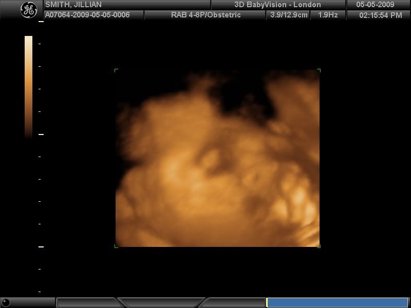 3d ultrasound 20 weeks boy. so 18-20 weeks for