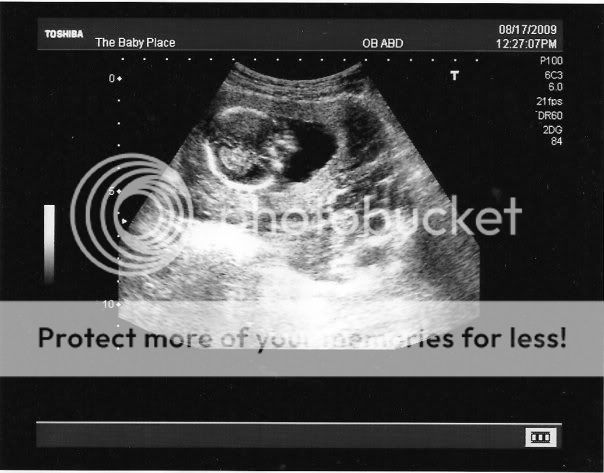 15 week ultrasound pics? - BabyGaga